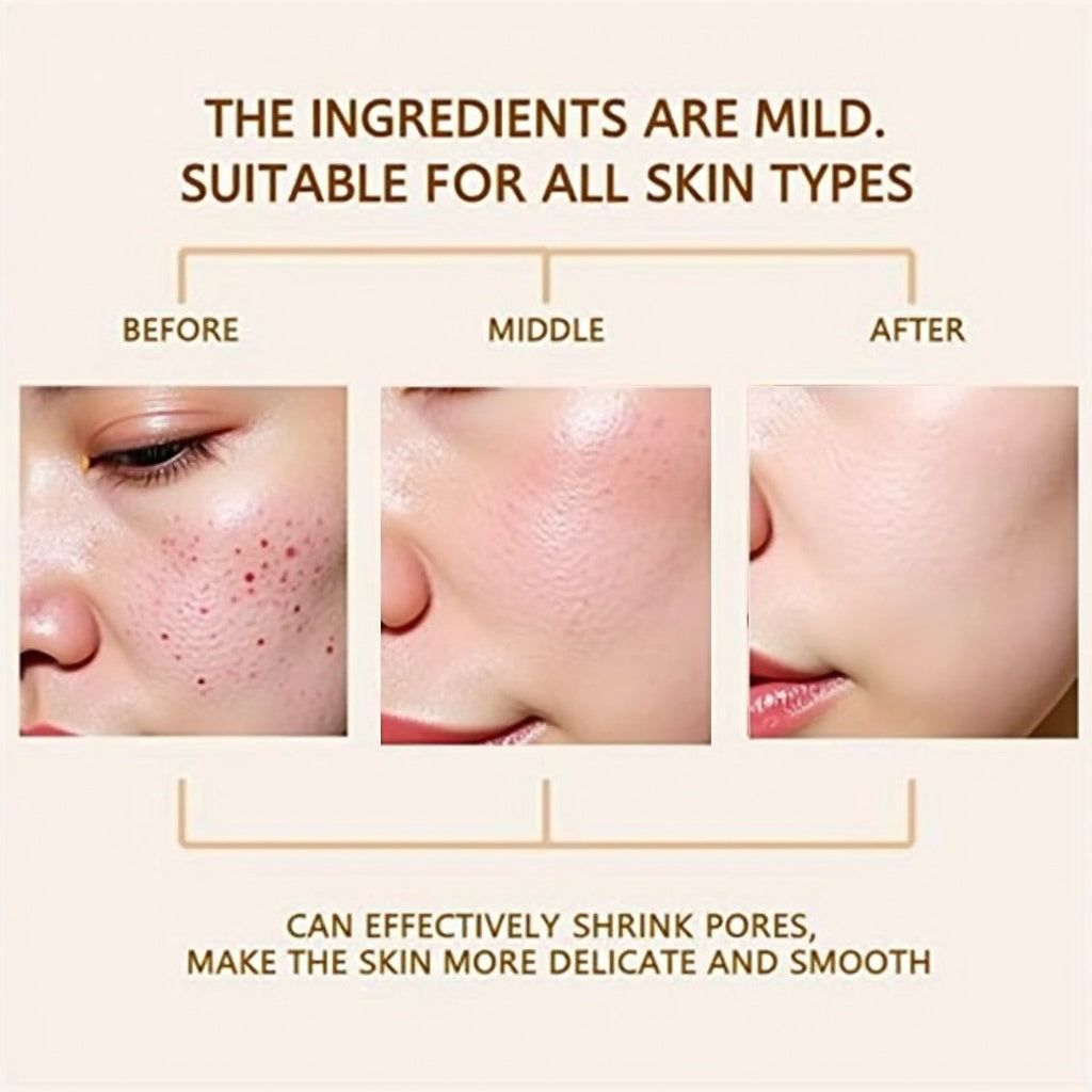 Dr. Melaxin Rice Exfoliating Serum Facial Moisturizing Soften Serum Blackhead Removal Hydrating Pore Shrinking Korean Skin Care