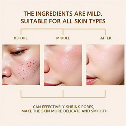Dr. Melaxin Rice Exfoliating Serum Facial Moisturizing Soften Serum Blackhead Removal Hydrating Pore Shrinking Korean Skin Care